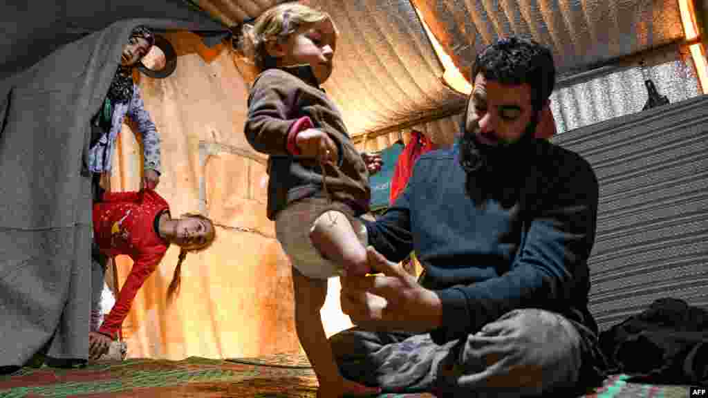Mohammed, the father of Syrian Maya Merhi, sits next to his disabled toddler, inside the family tent at an Internally Displaced Persons (IDP) camp in Syria&#39;s rebel-held northwestern Idlib province, near the Bab al-Hawa border crossing with Turkey.