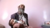 Yemen’s Collapsing Health System Unable to Cope with Disease Upsurge