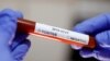 Epruveta sa testom na koronavirus