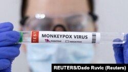 资料照片：显示猴痘病毒呈阳性的试管。（2022年5月23日）
