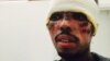 Migrant dont le visage a été brûlé par des passeurs en Libye (Rosamaria Vitale) 