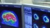 Brain scan