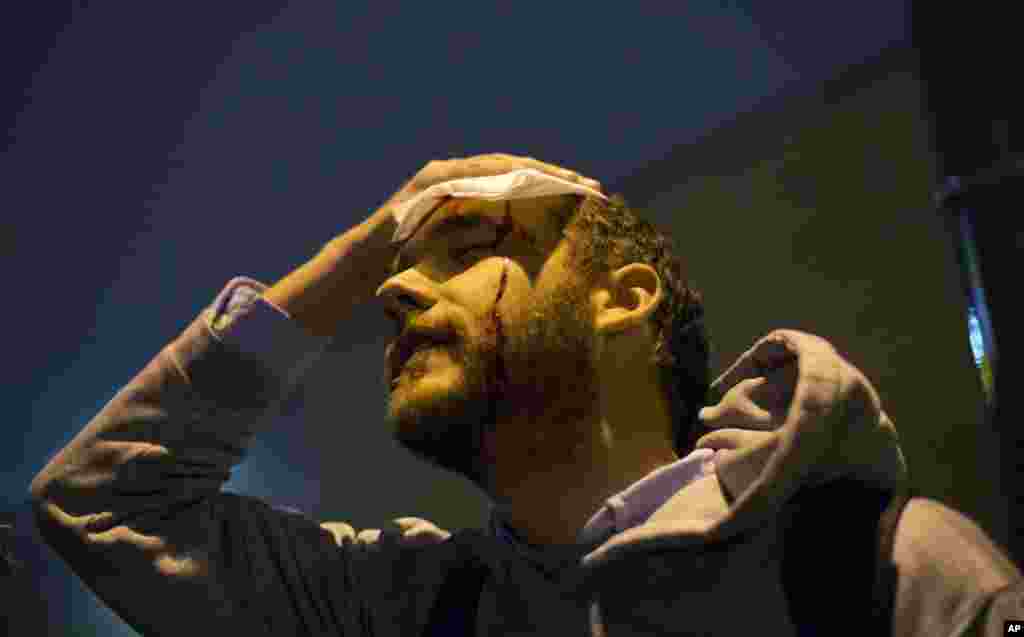 Matt Pearce, wartawan Los Angeles Times, memegang kepalanya yang terkena batu yang dilempar kerumunan massa dalam protes melawan penembakan remaja berkulit hitam Michael Brown, di St. Louis, Missouri (23/11). (AP/David Goldman)