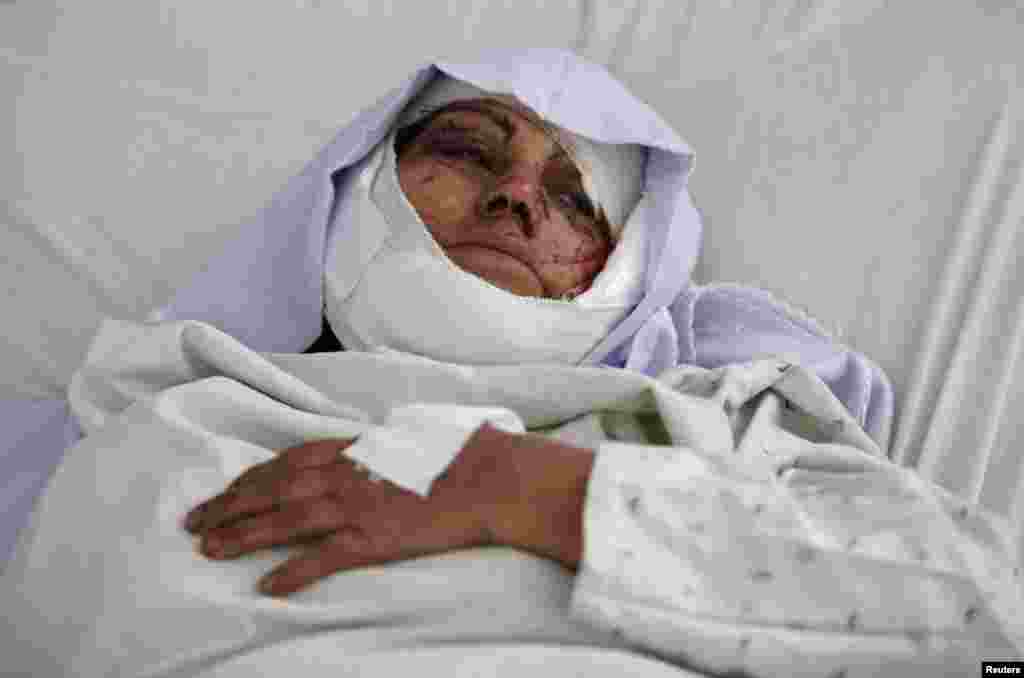 A wounded Afghan woman lies at the hospital after a suicide attack in Kabul, May 16, 2013. 