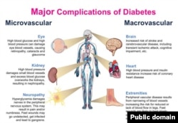 Diabetes