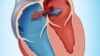Hole In Heart