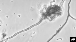 La variante de la méningite fongique rare à l'origine de l'épidémie 