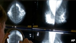 Radiolog koristi lupu kako bi provjerio mamografe za rak dojke u Los Angelesu 6. maja 2010.